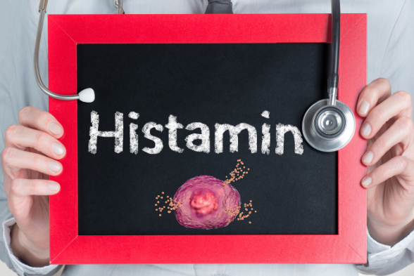 Histamine Intolerance symptoms diagnosis treatment supplements