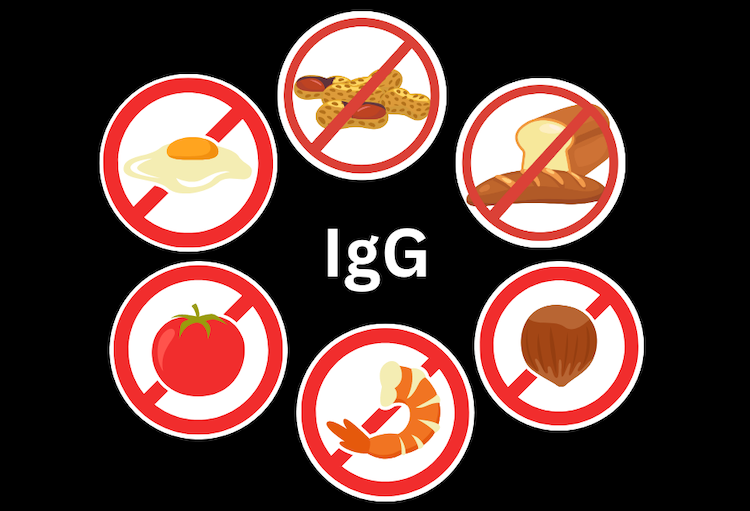 IgG food sensitivity testing