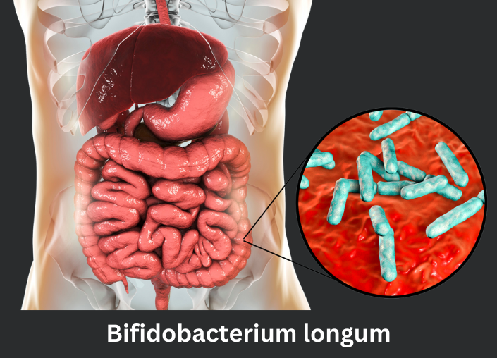 Bifidobacterium longum - A Key Player in Gut Health Restoration